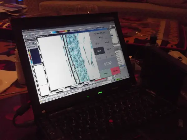 Imedeen Skin Scanner